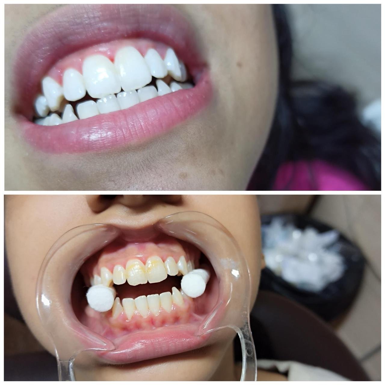 بعض الحالات قبل وبعد - محمد مشهور أحمد حسانين