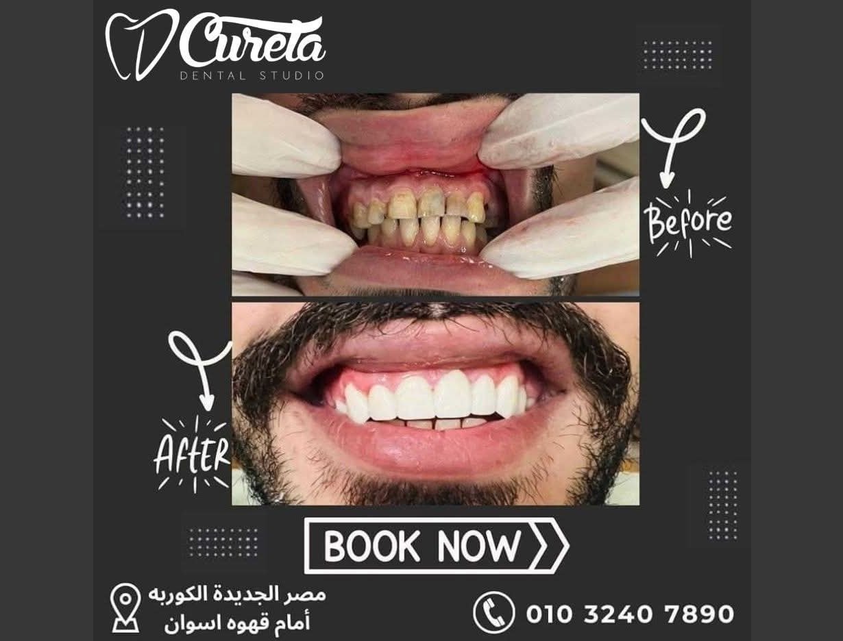 بعض الحالات قبل و بعد - حسام الشامي