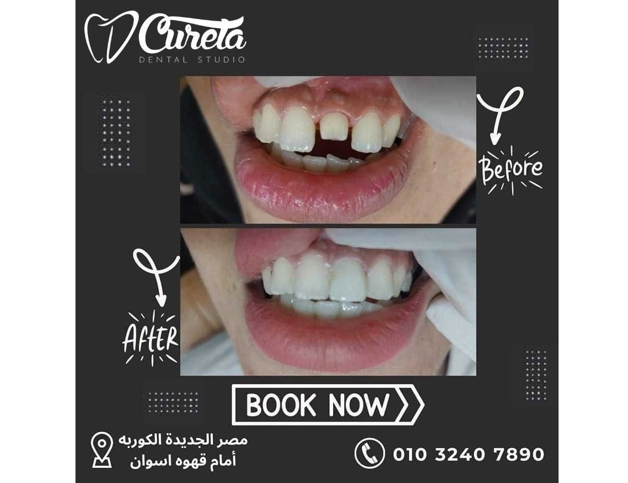 بعض الحالات قبل و بعد - حسام الشامي