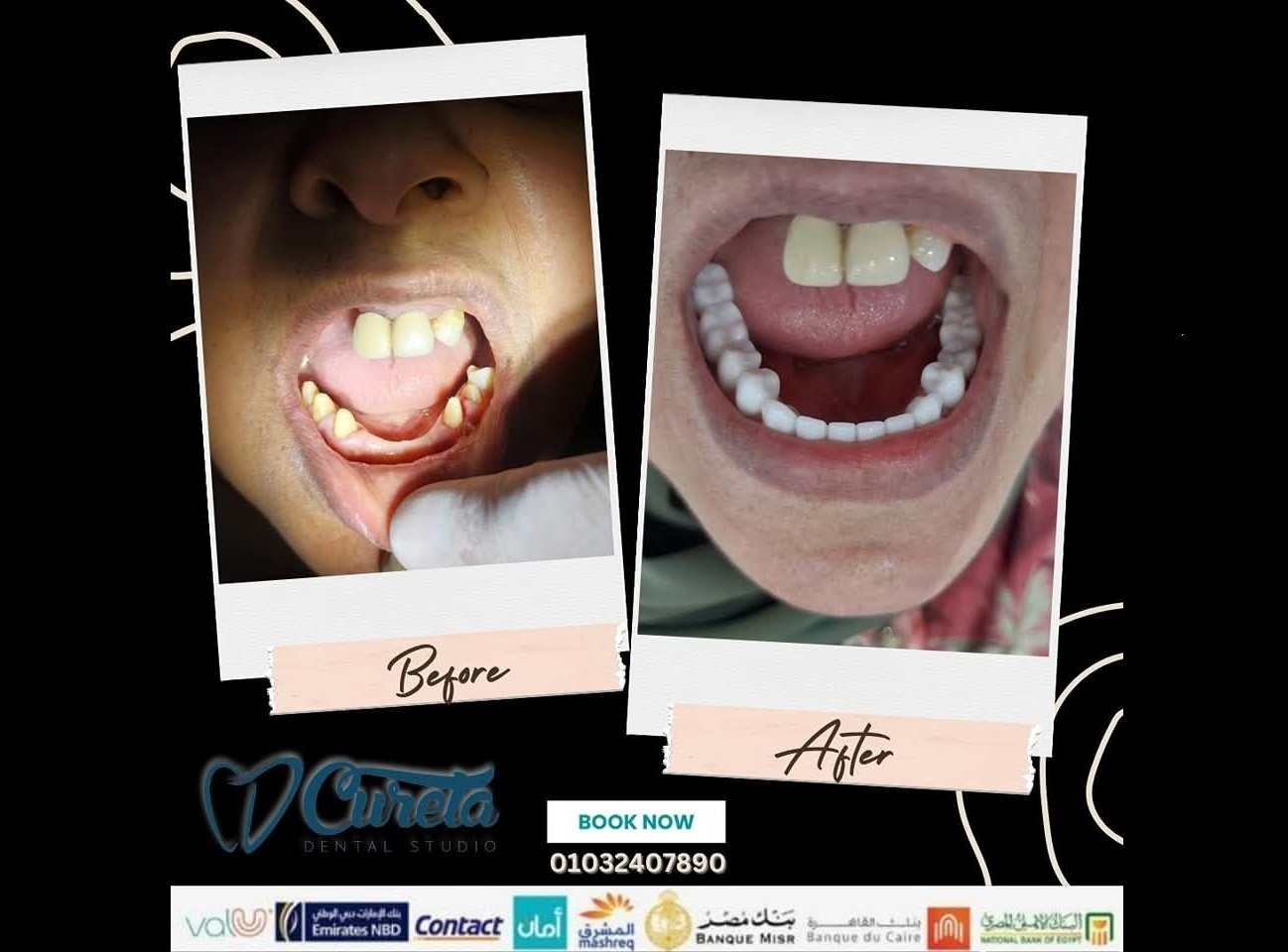 بعض الحالات قبل و بعد - حسام الشامي