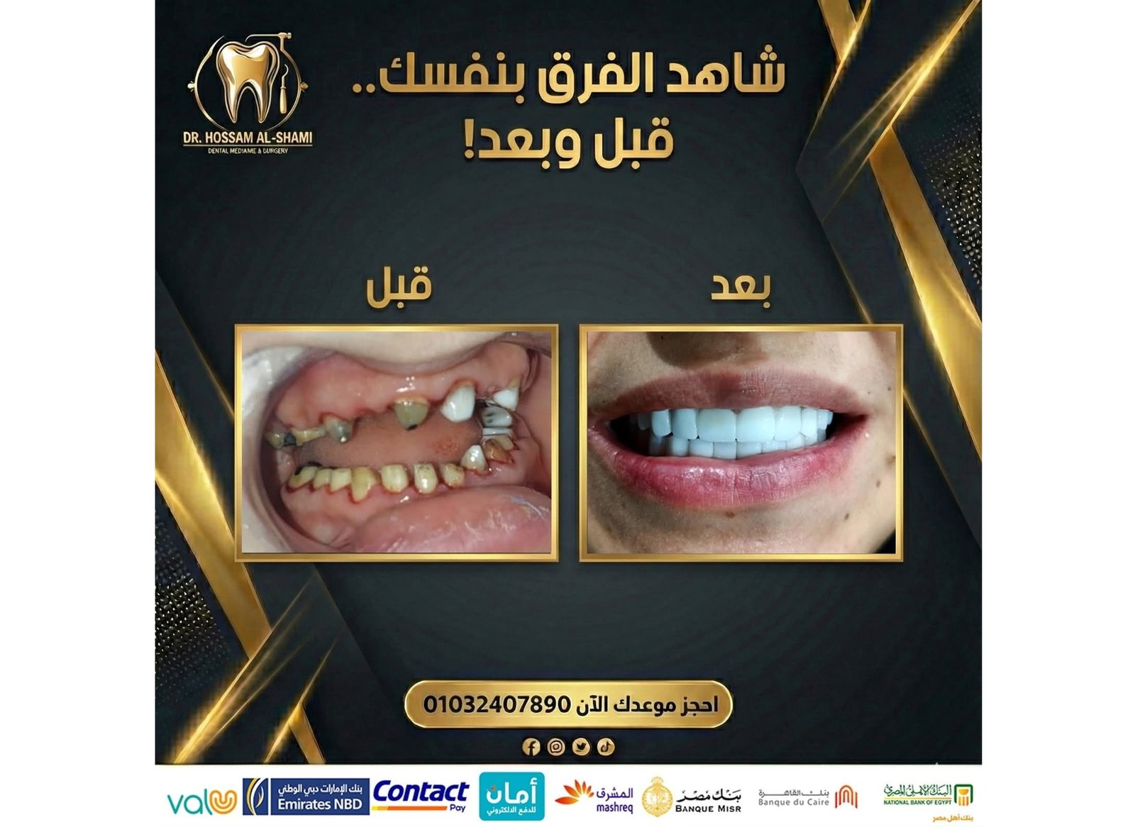 بعض الحالات قبل و بعد - حسام الشامي