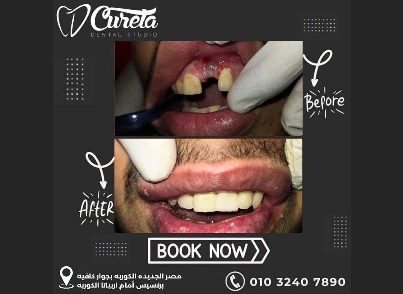 بعض الحالات قبل و بعد - حسام الشامي