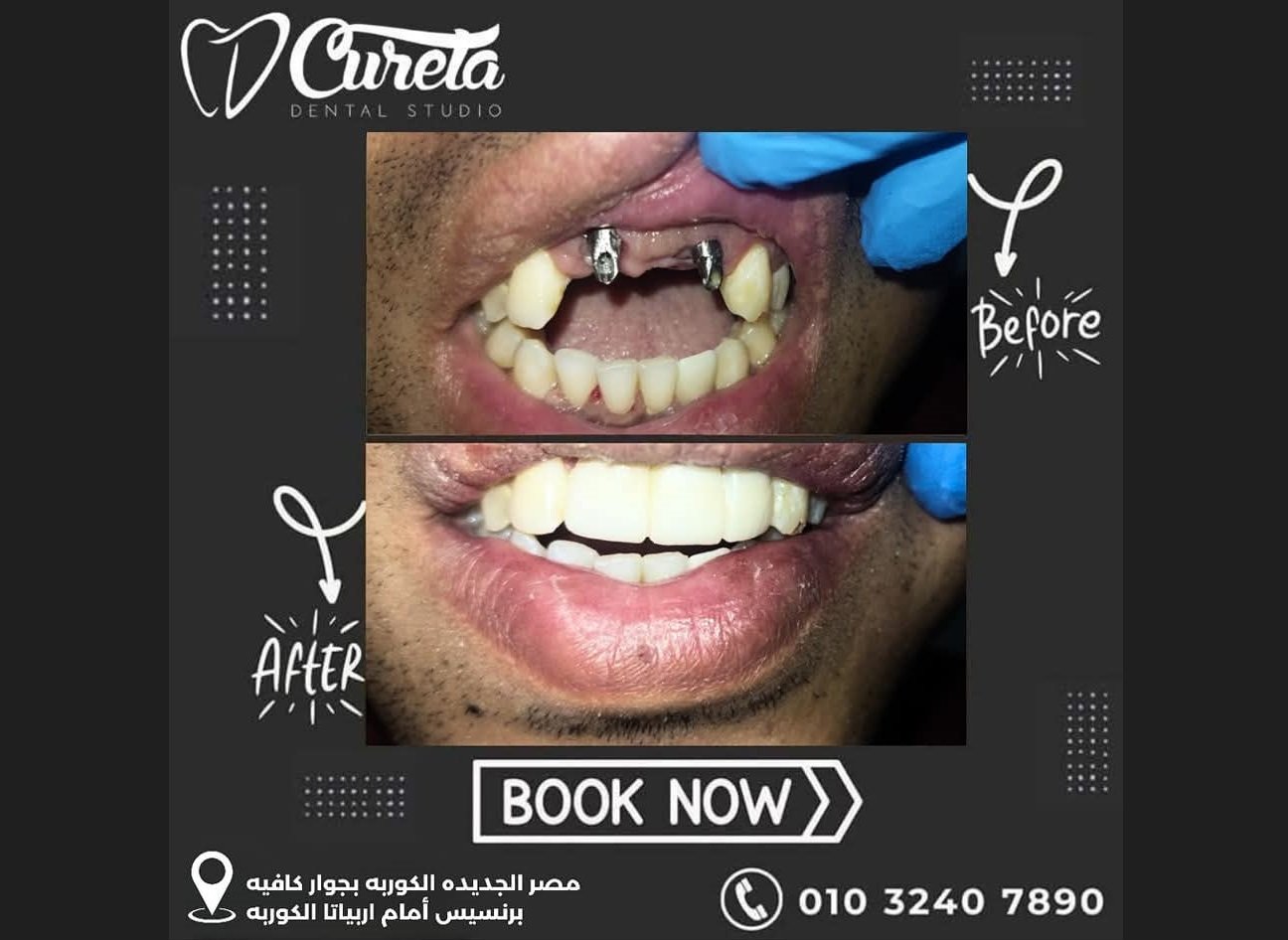 بعض الحالات قبل و بعد - حسام الشامي